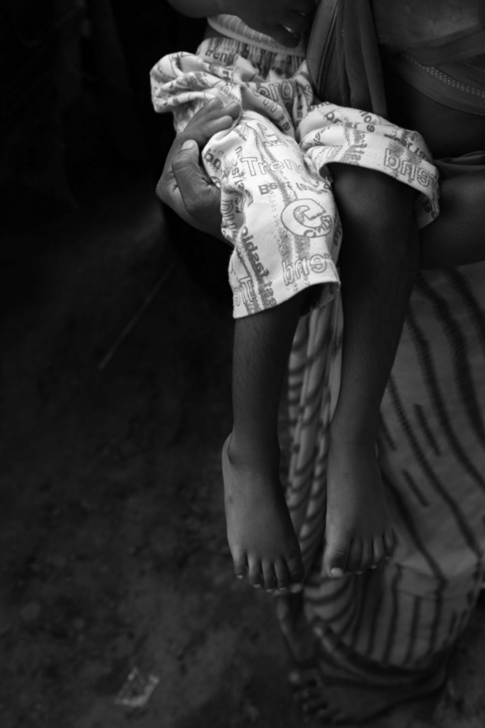 Chingari rehabilitation center 16